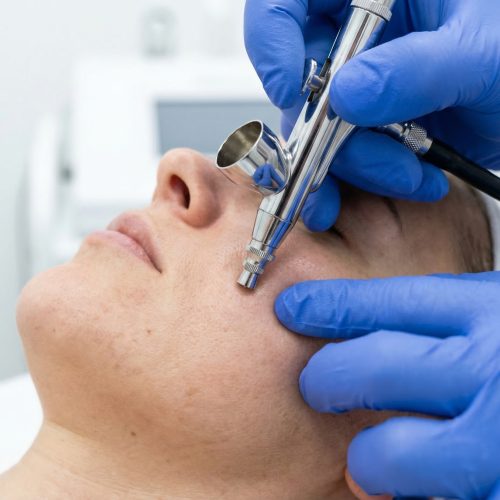 carboxi:oxigenoterapia